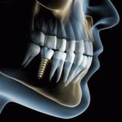 Zahn4me Dentallabor-Ettenauer Gesellschaft m.b.H., Josefstadt, Wien - Öffnungszeiten