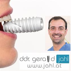 DDr. Gerald Jahl / Implantat im Zentrum- Allon4, Krems an der Donau Öffnungszeiten